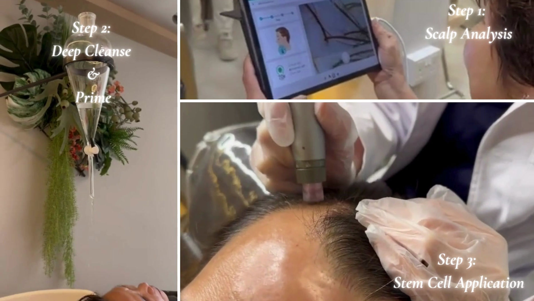 Cellular Hair Regrowth Treatment Video
